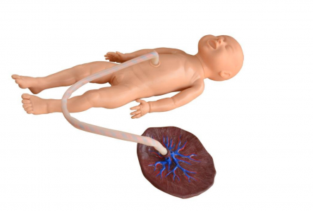 Advanced Neonate Umbilical Cord Nursing Model